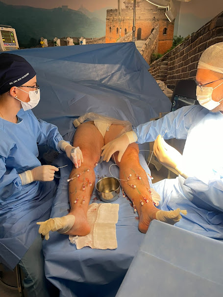Tudo Sobre Varizes nas Pernas 7 varizes na perna Cirurgia de varizes nas pernas