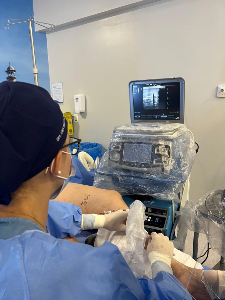Endolaser - tratamento 100% guiado por ultrassom