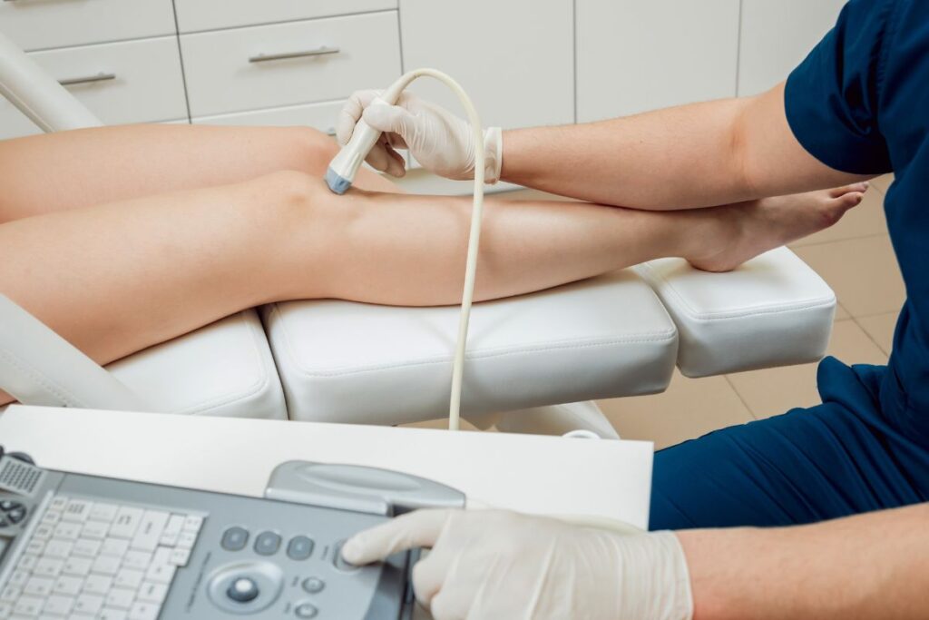 quanto tempo de repouso após aplicação de varizes