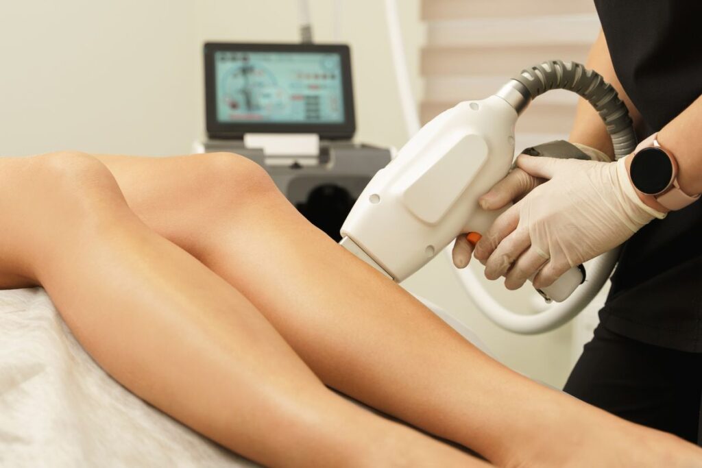 Quanto Custa Tirar Varizes a Laser