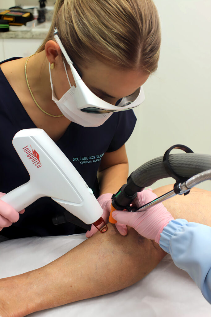 Cirurgia de varizes a laser é perigosa? 1 cirurgia de varizes a laser é perigosa Cirurgia de varizes a laser e perigosa cirurgia de varizes a laser é perigosa