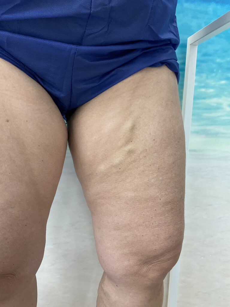 Como Evitar Varizes nas Pernas: 3 Dicas Práticas e Eficazes 3 medico que cuida das varizes Como Evitar Varizes nas Pernas 3 Dicas Praticas e Eficazes como evitar varizes nas pernas